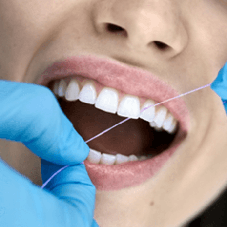 Dentist with blue gloves flossing patient's teeth