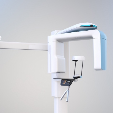 C T cone beam x-ray scanner system