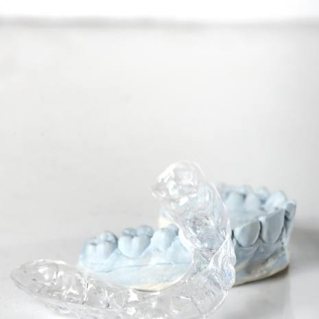 Clear braces tray and smile model crafted using digital impression system
